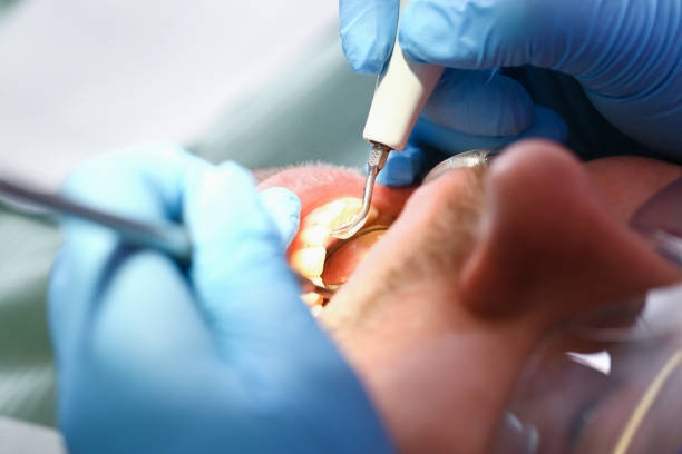 Best Emergency Dental Extractions in Ridgefield Park, NJ