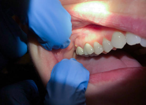 Best Emergency Dental Services for Seniors in Ridgefield Park, NJ